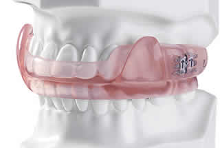 Dealing with Common Dental Problems