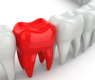 What is a Dental Emergency?